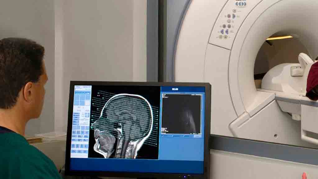 Using Machine Learning to Identify Diseases Through MRI Scans